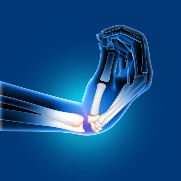 Total Elbow Replacement Surgeon in pune